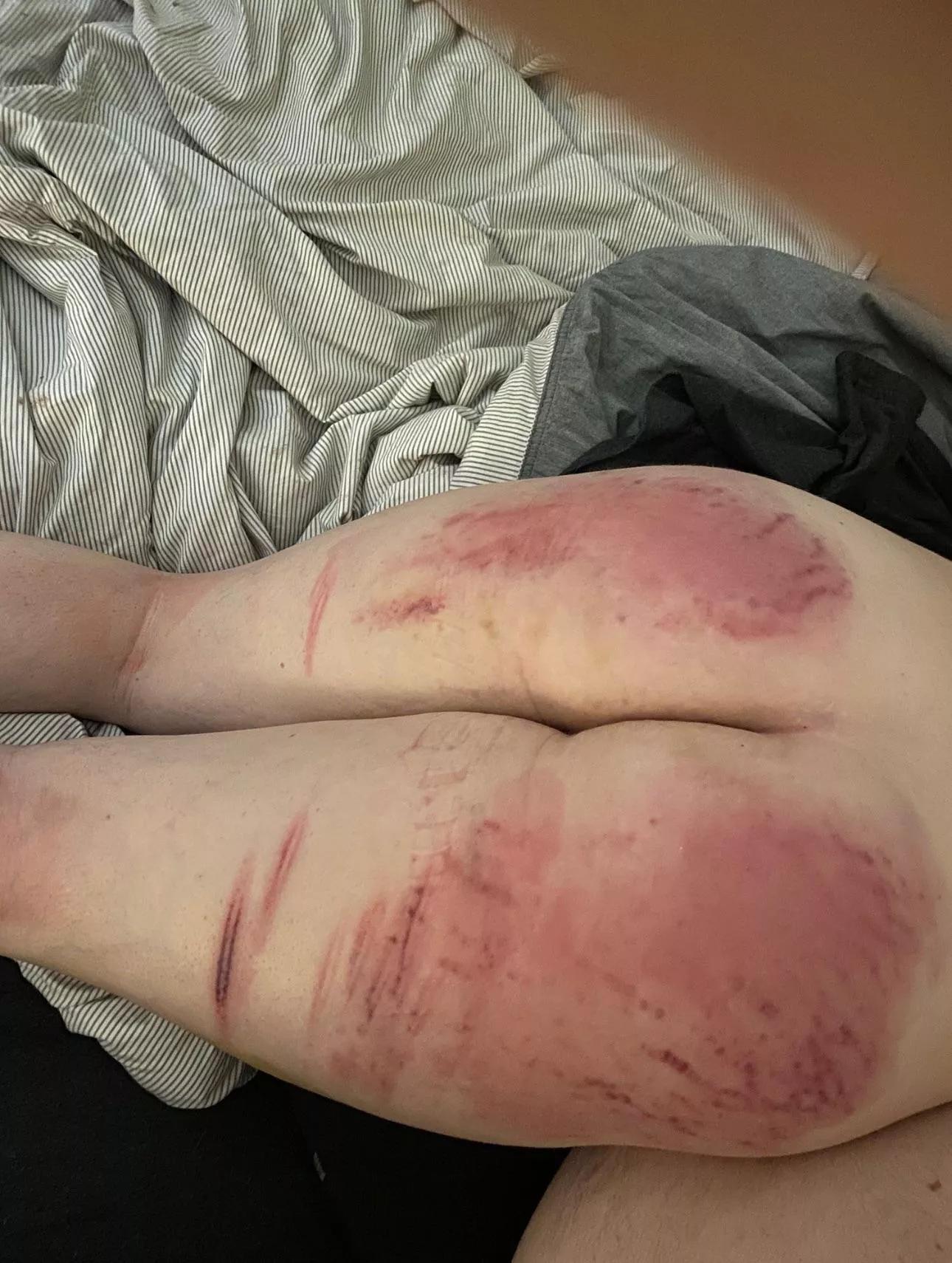 What all do you think was used during my punishment? 