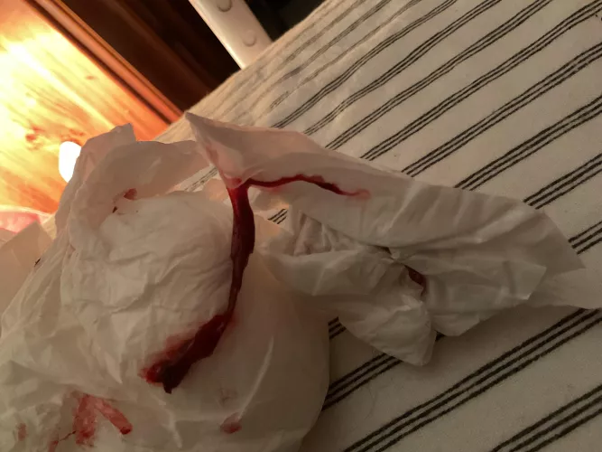 Just pulled this out of my nose