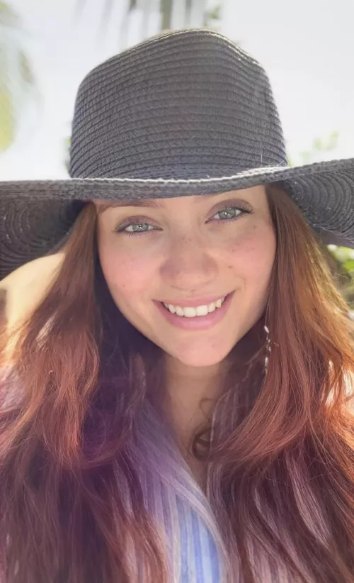 My eyes are up here. My freckles are everywhere