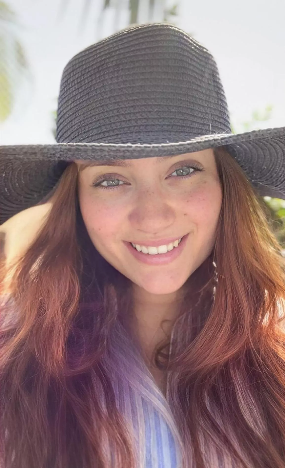 My eyes are up here. My freckles are everywhere