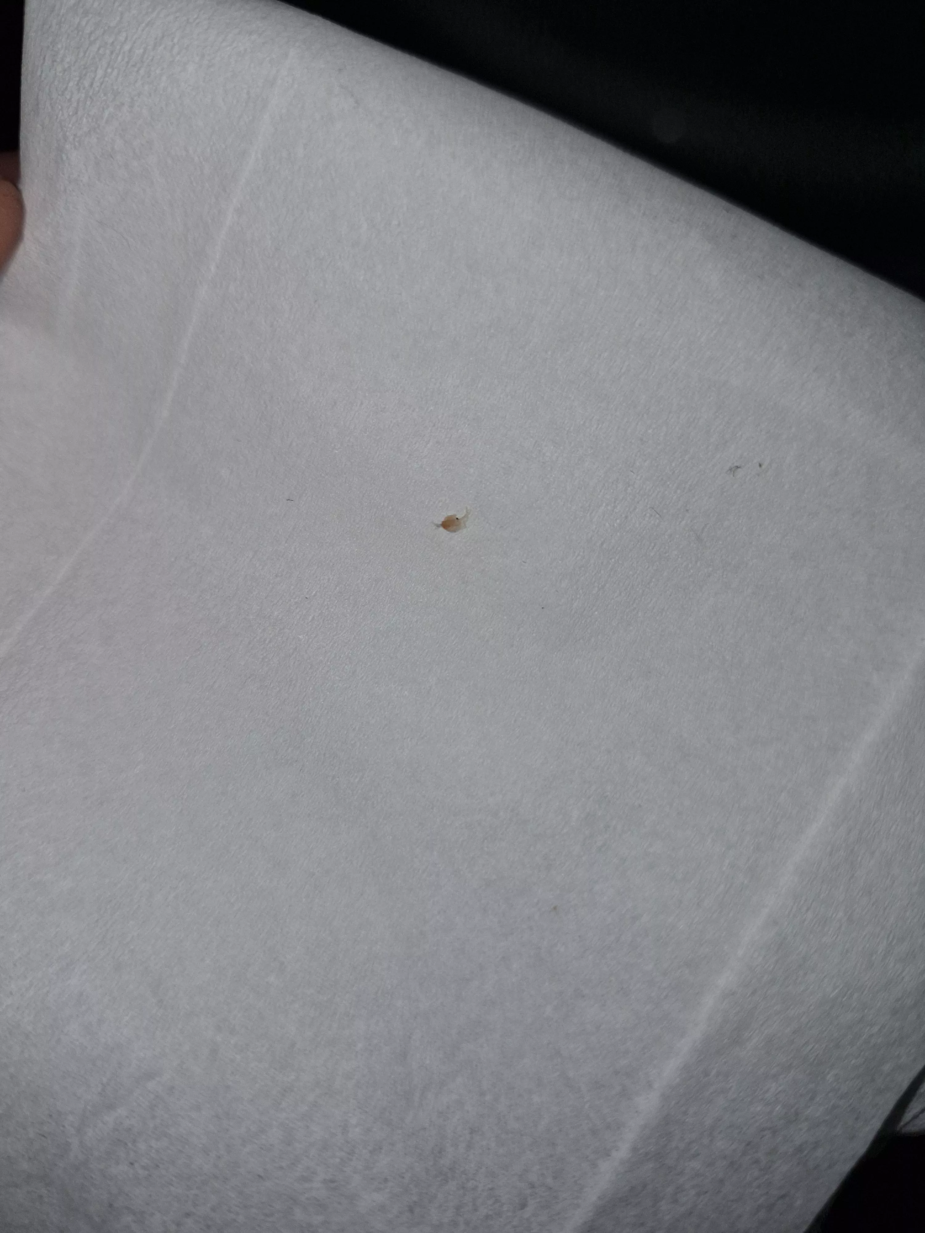 Popped this out of my stomach, felt like an insect bite but it's firm