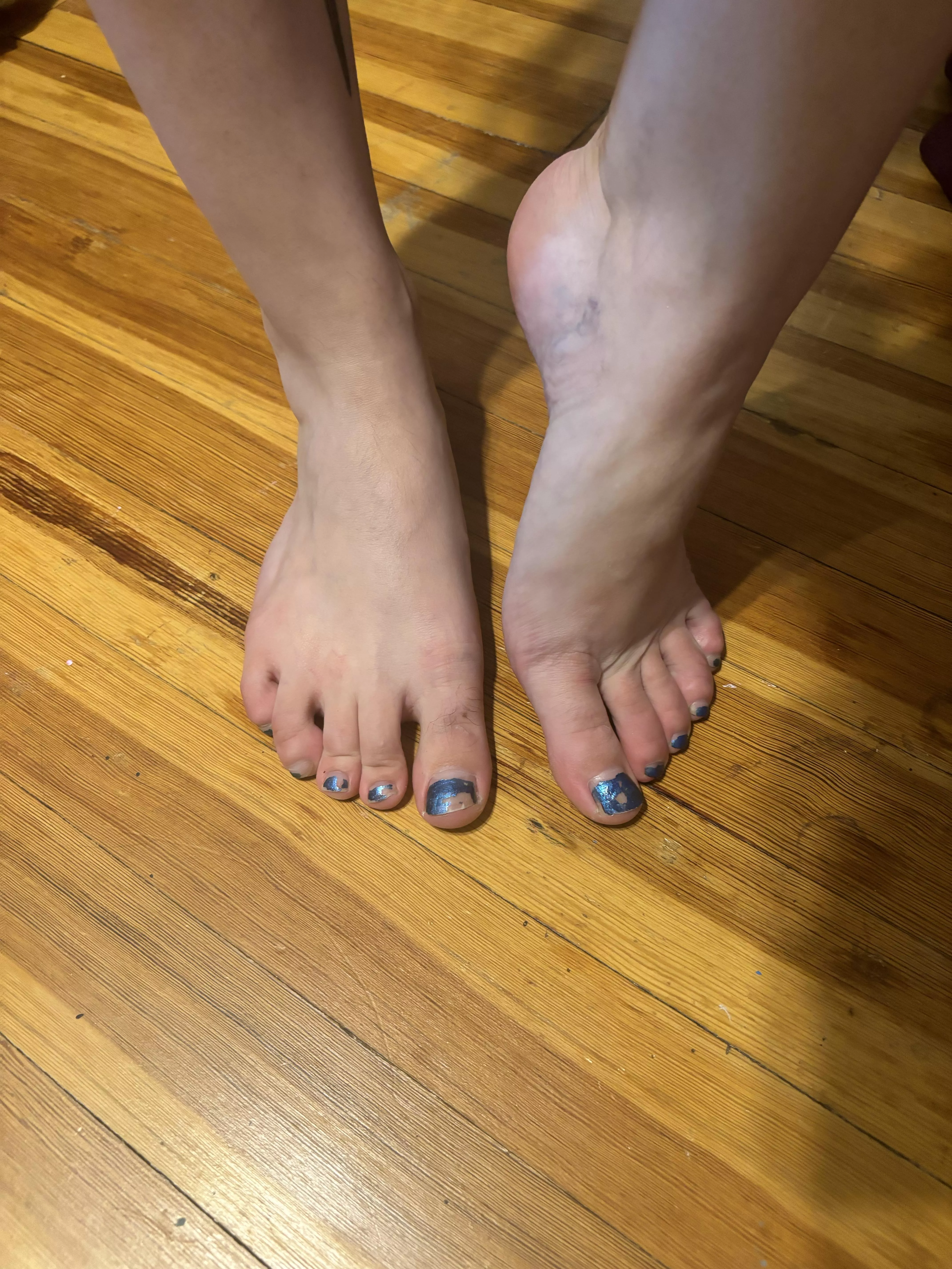 Chipped blue toes