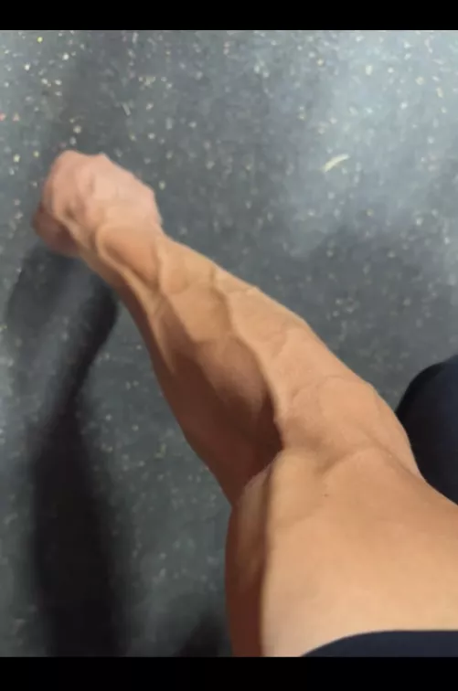 Any nurses here? They get so excited when drawing my blood