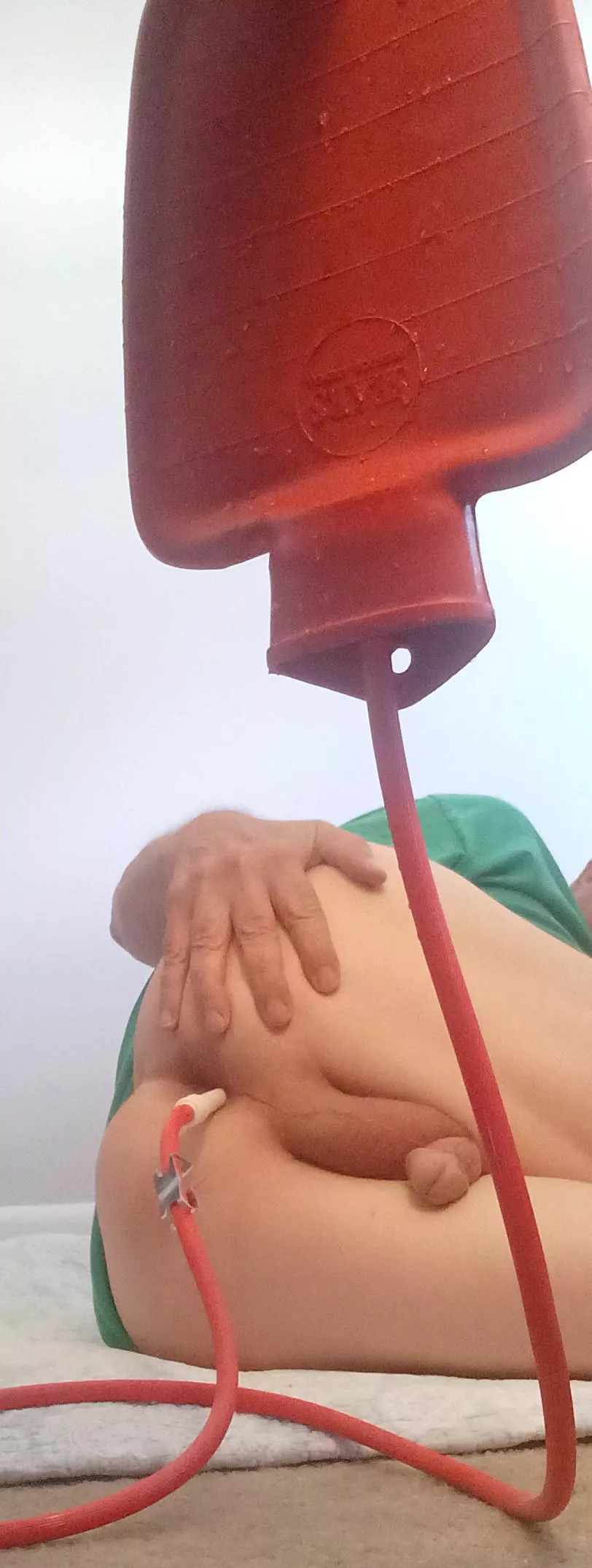 Flat Enema Bag and Full Belly