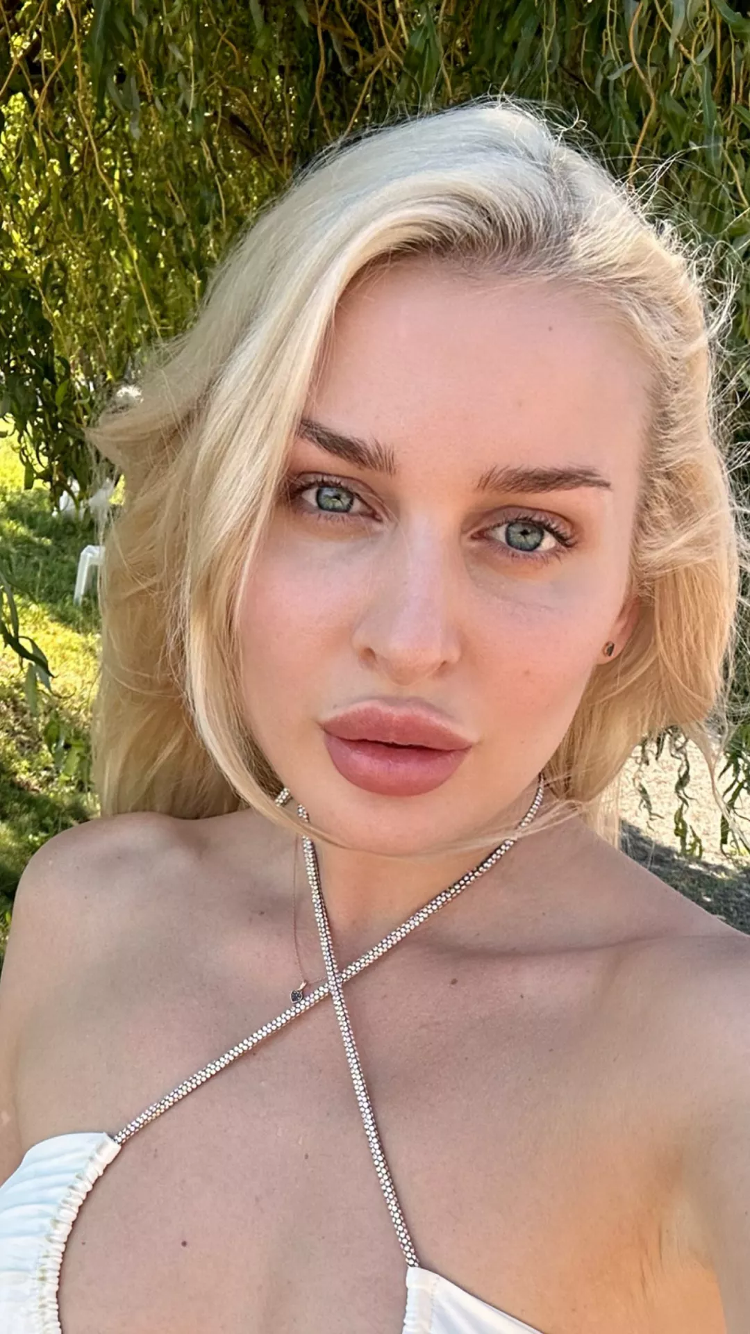 Are the lips overfilled or just perfect