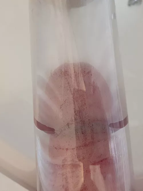 Corona and head swell way more than shaft when pumping. Is this normal??