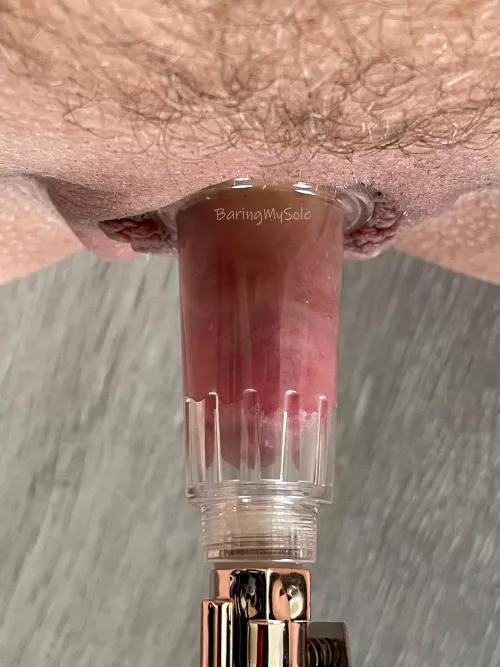 I just about filled the tube with my fat pumped clit