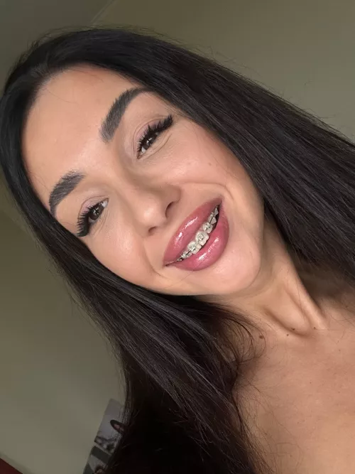 Adorable girl with braces