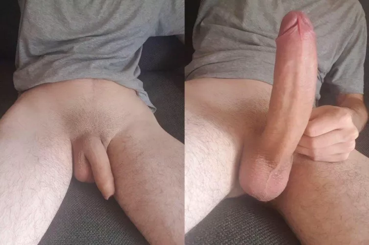 What’s your opinion before and after? (21)