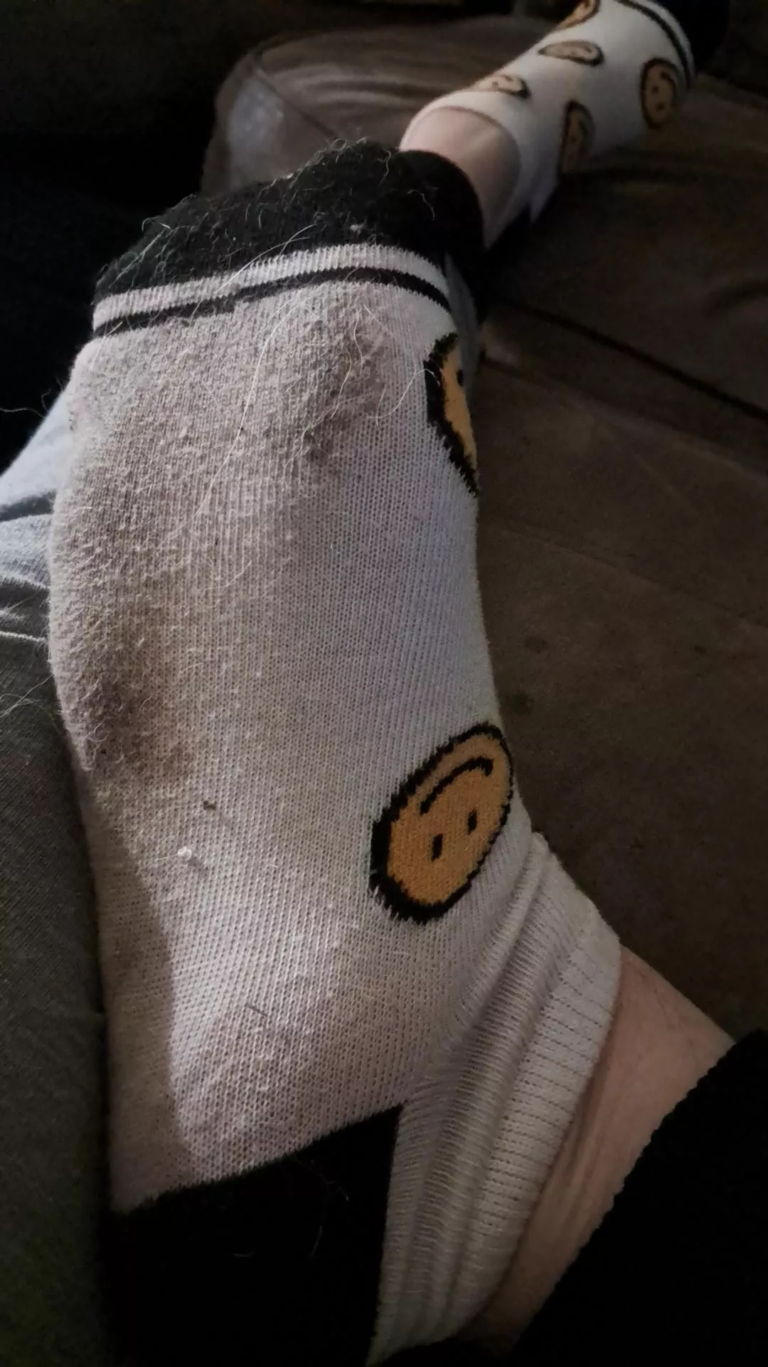 They used to be white but oh well 