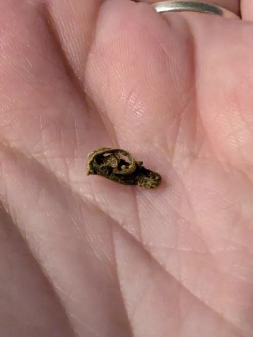 Ingrown hairs run in my family, I thought because I was blonde I was exempt, I was not. 