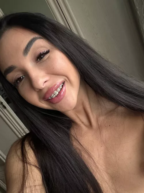 Hello, how does my smile look to you