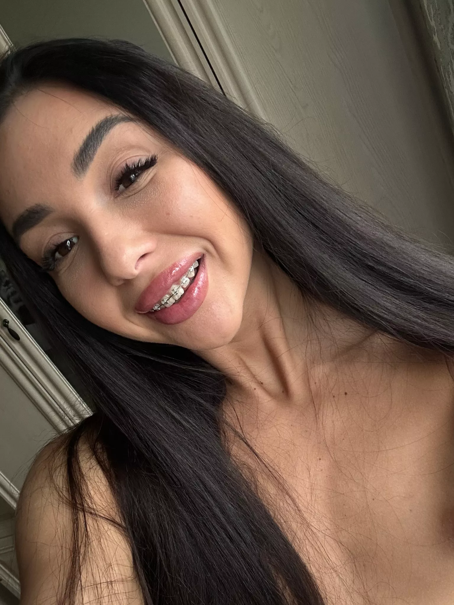 Hello, how does my smile look to you