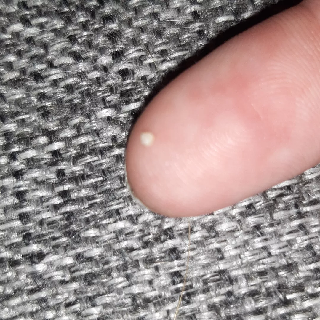 Squeezed out of pubic area