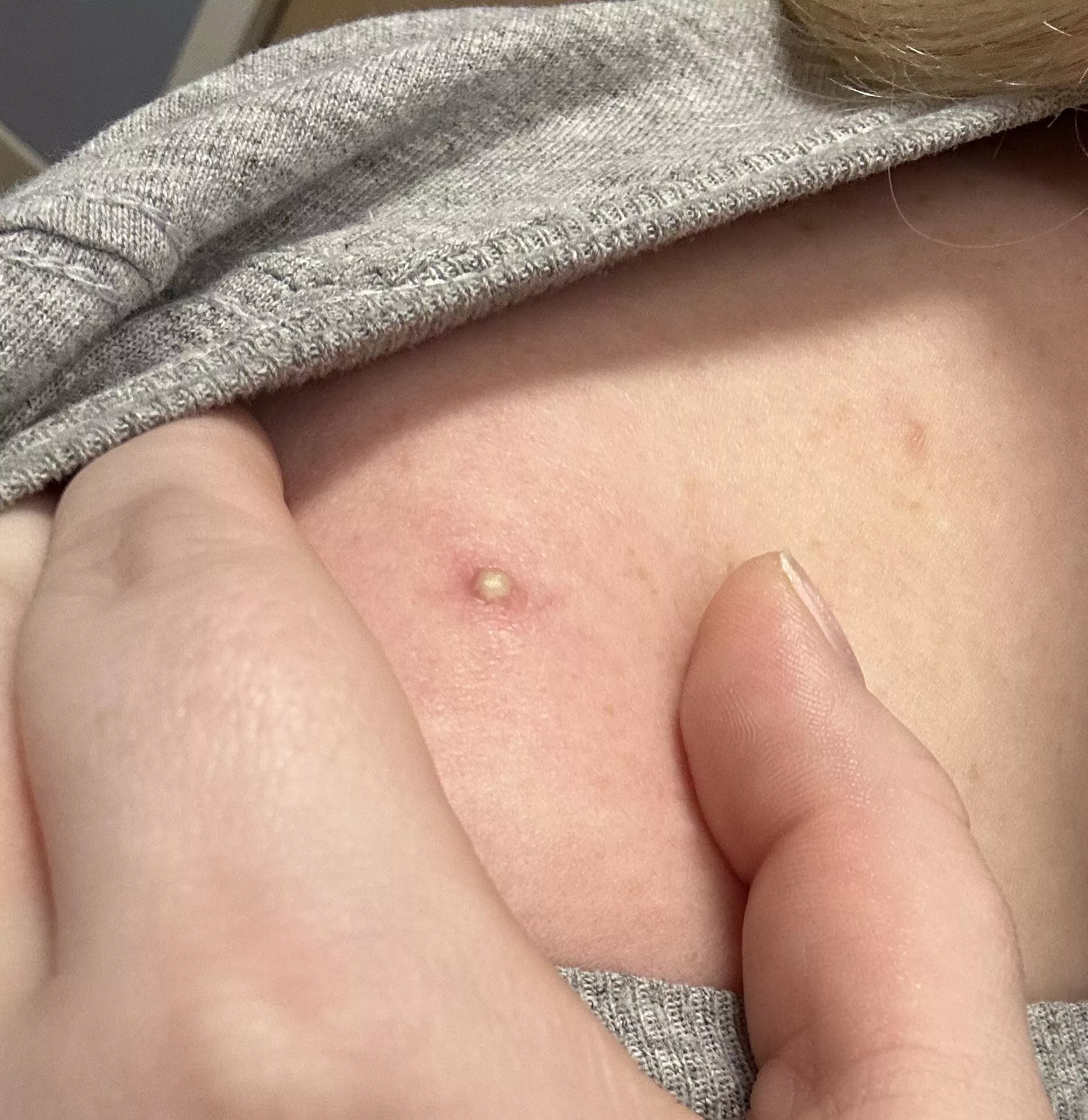 The prettiest white head 