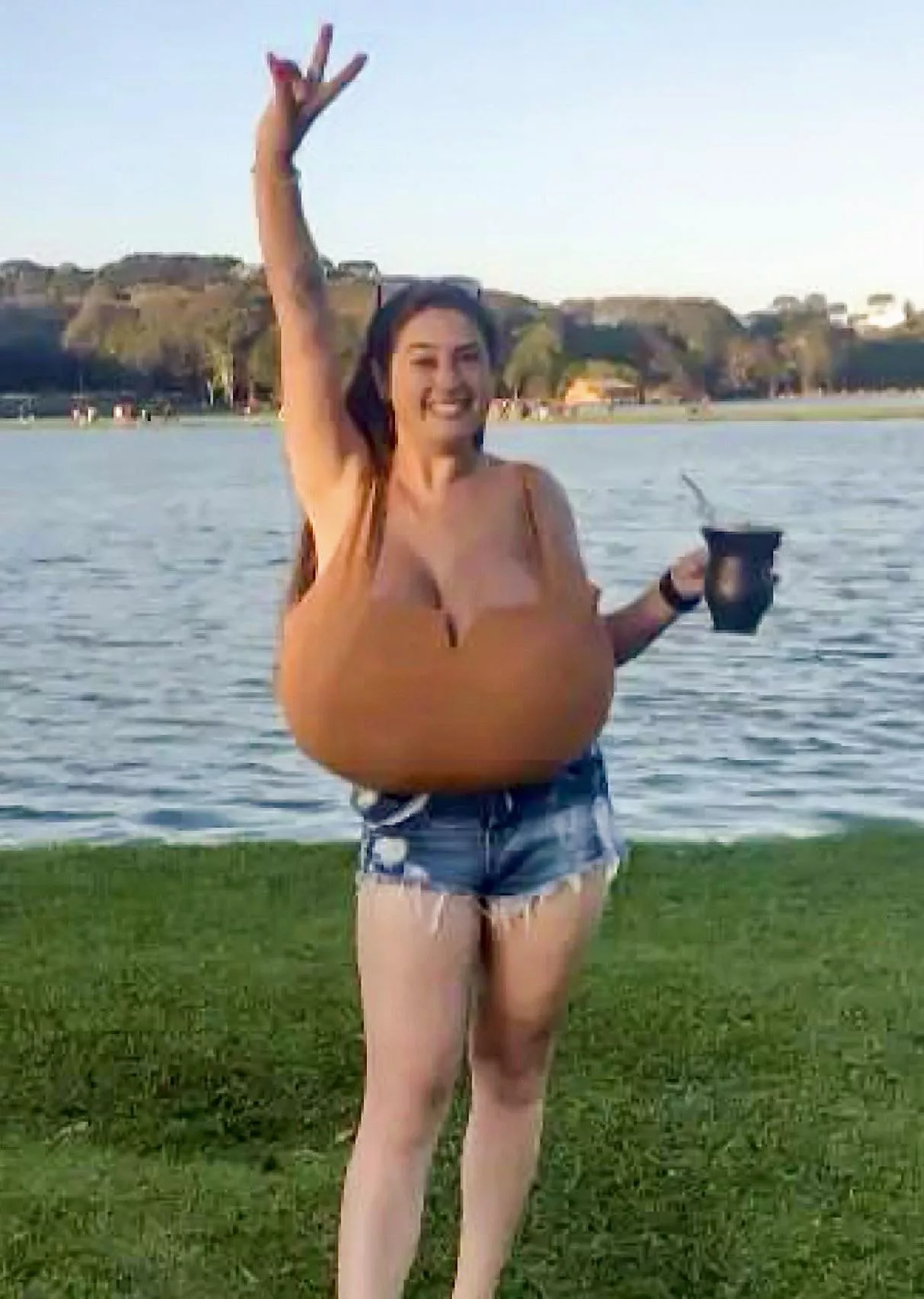 Gigantomastia at its best