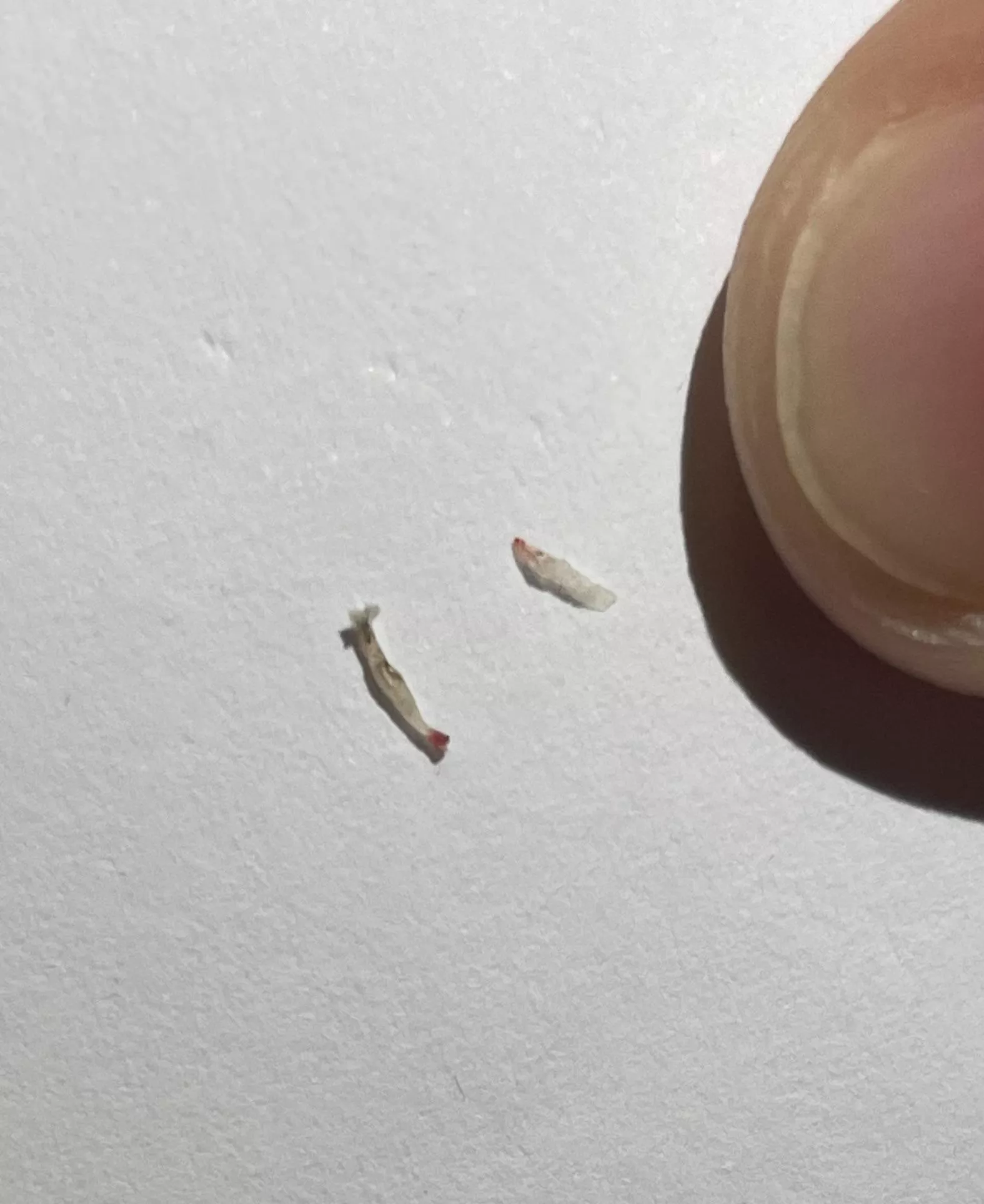 I tweezed something strange from my skin