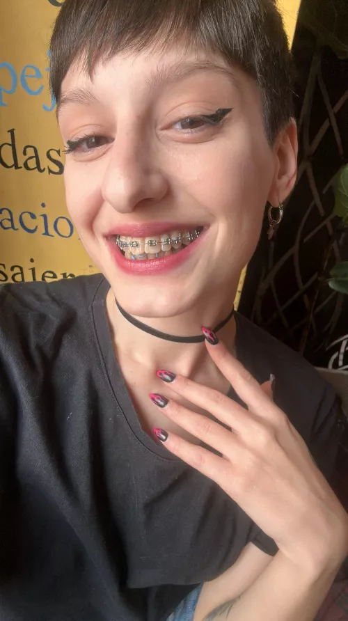 is there a better combo than short hair with braces?