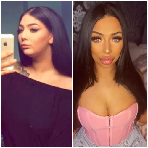 mmm i think my after is much better! 💋🫧🍭💗🎀