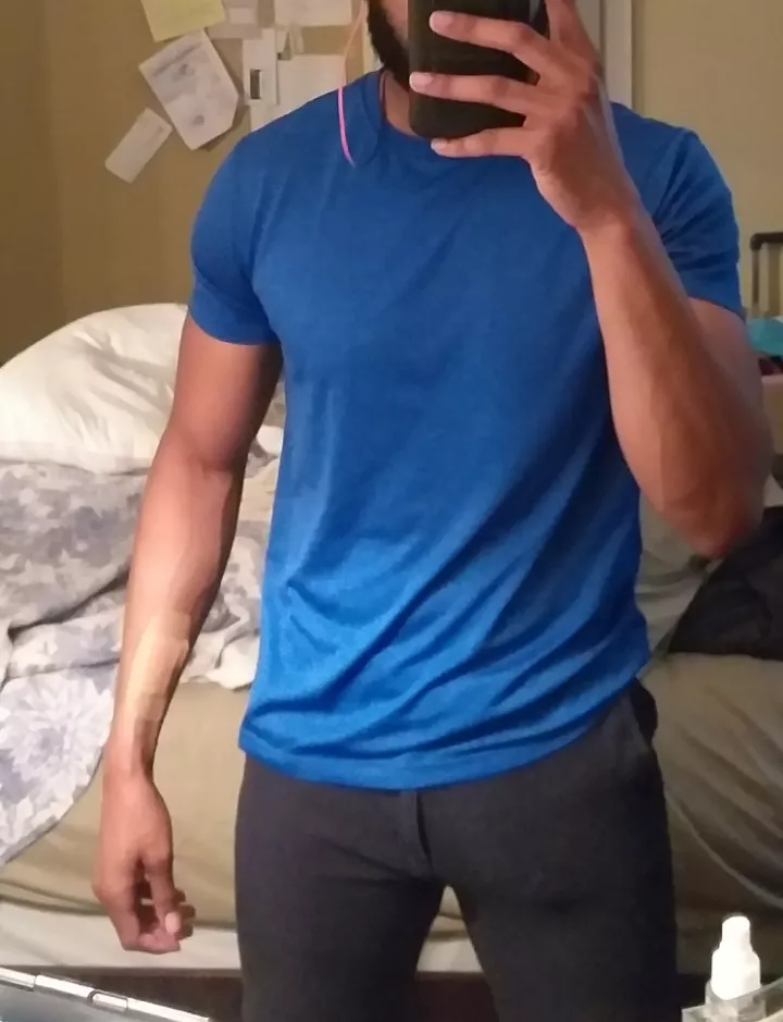 Took a lot of nerve to wear these shorts