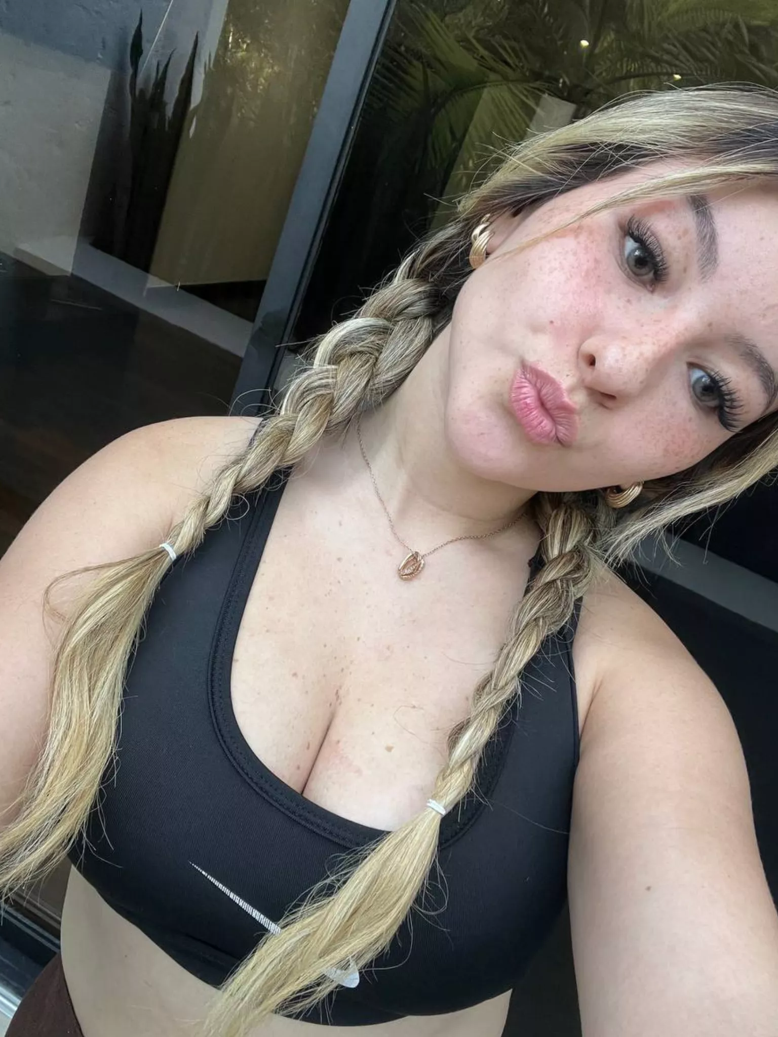Am I attractive with all these freckles?