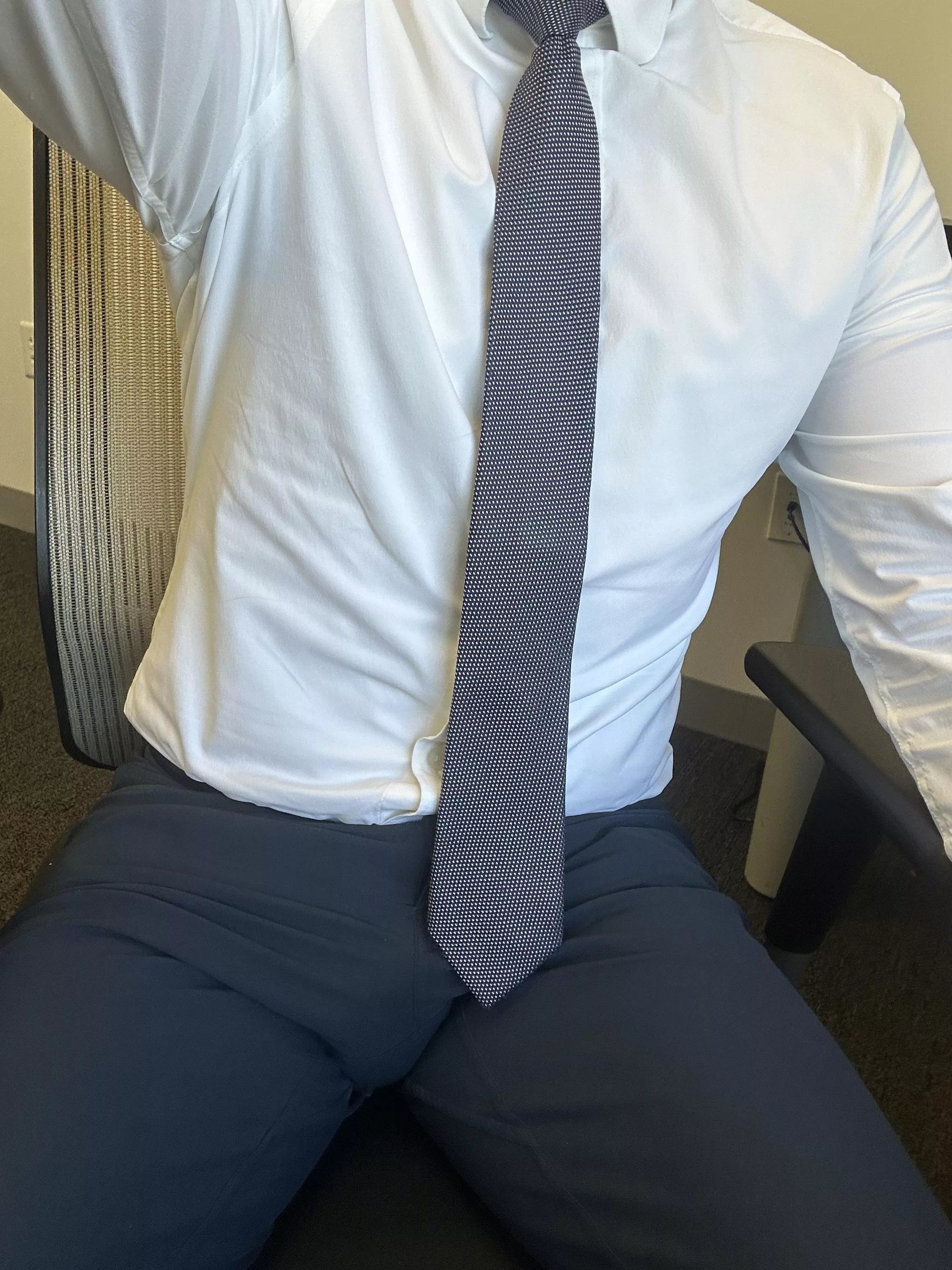 Back and bulging at the office. Who can help with this? (30) 