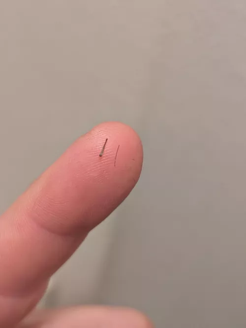 Different whisker thickness from pimple