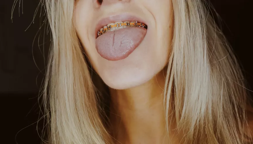 What would you do if you saw me on the street and I poked my tongue out at you like this