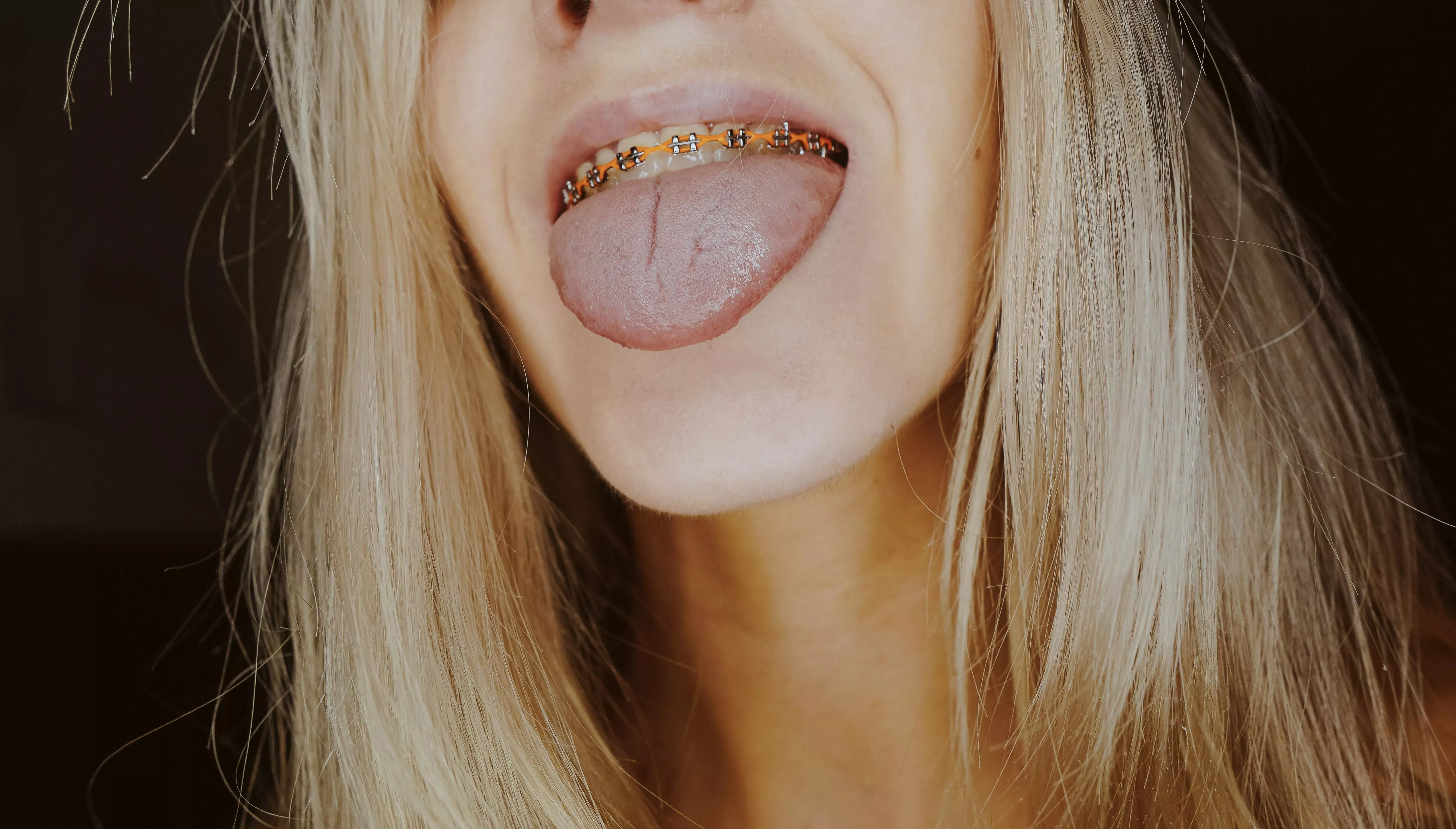 What would you do if you saw me on the street and I poked my tongue out at you like this