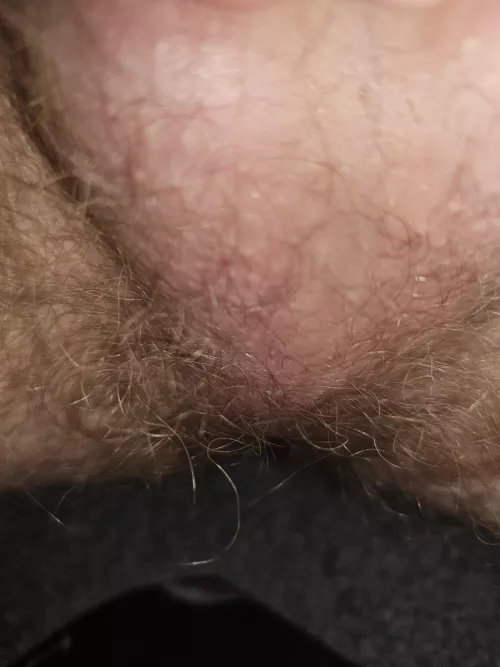 Been scratching and sniffing all morning. 