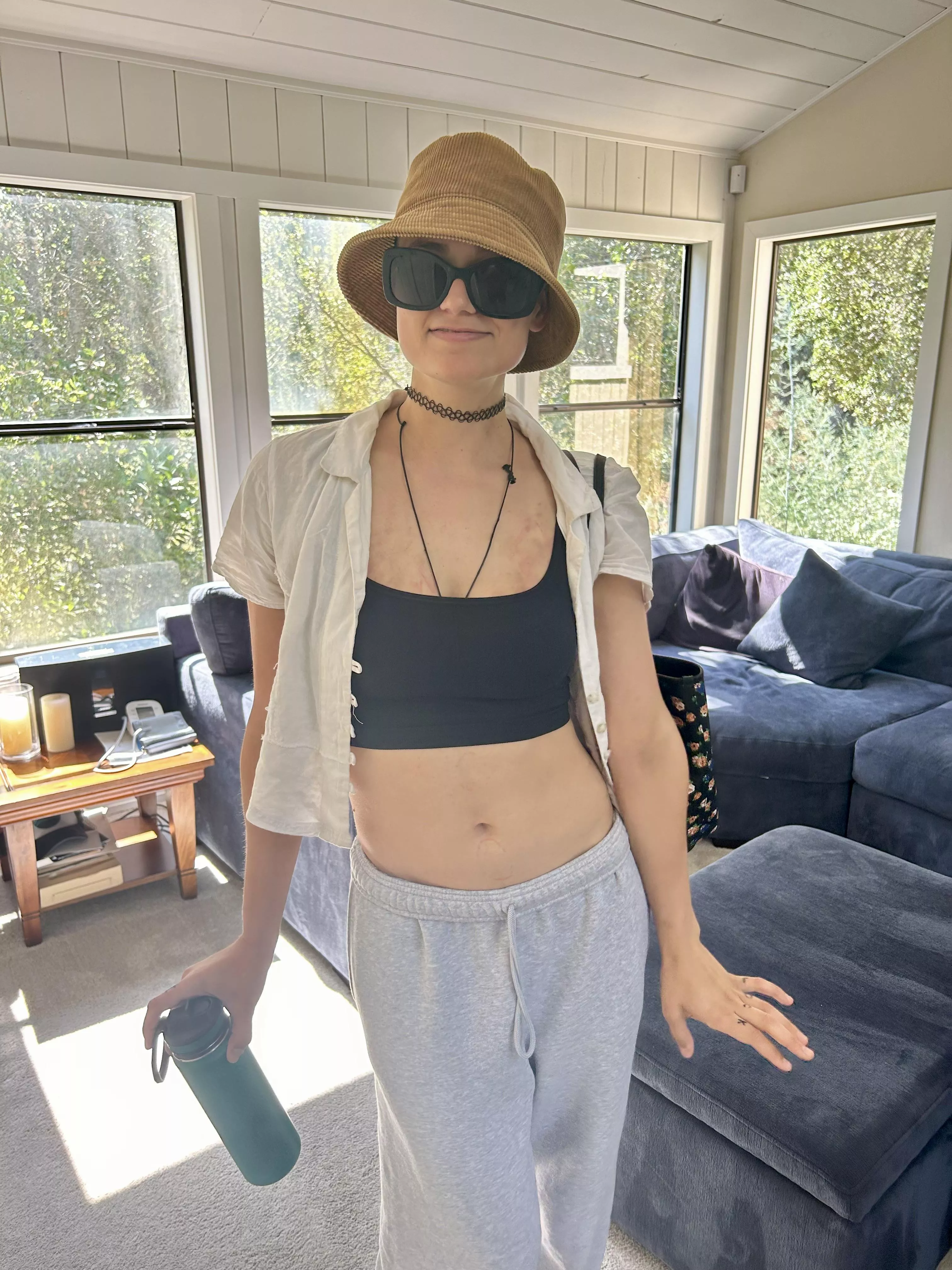 bruises and bite marks all over like a lucky girl