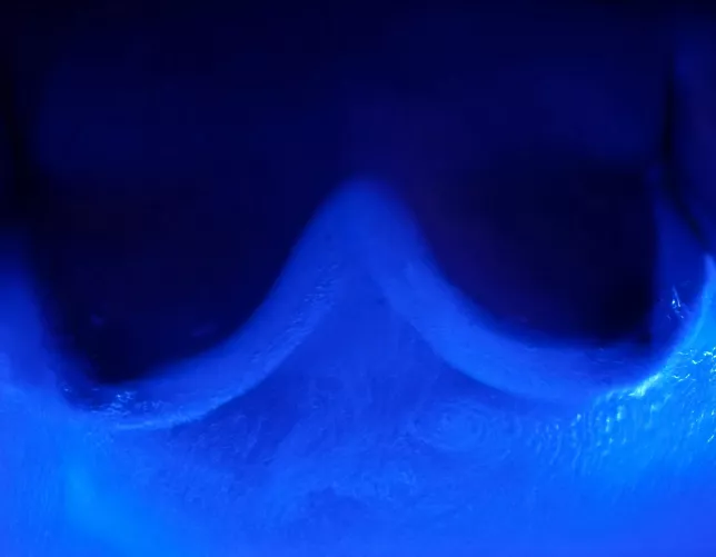 Hot tub boobs. Who loves vacation?