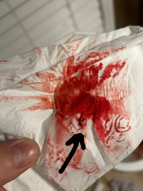 Is this intestinal lining?