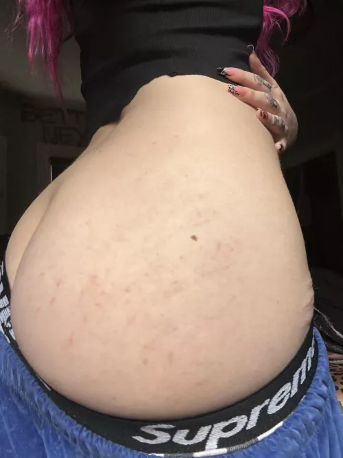 light bruising from getting spanked,,, i deserve more💗