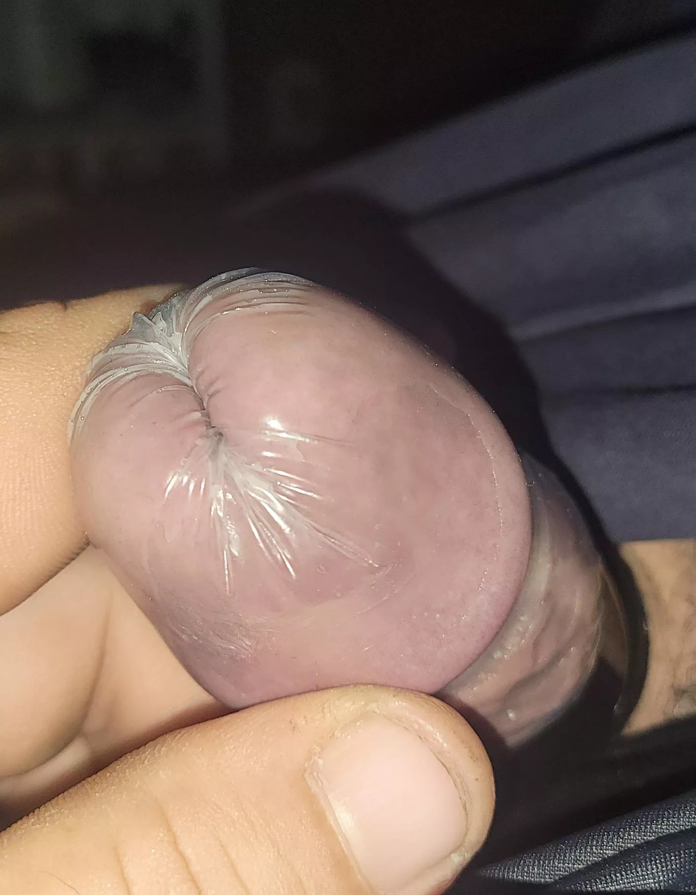 [M] Foam earplug inside condom, slid deep down the hole. 