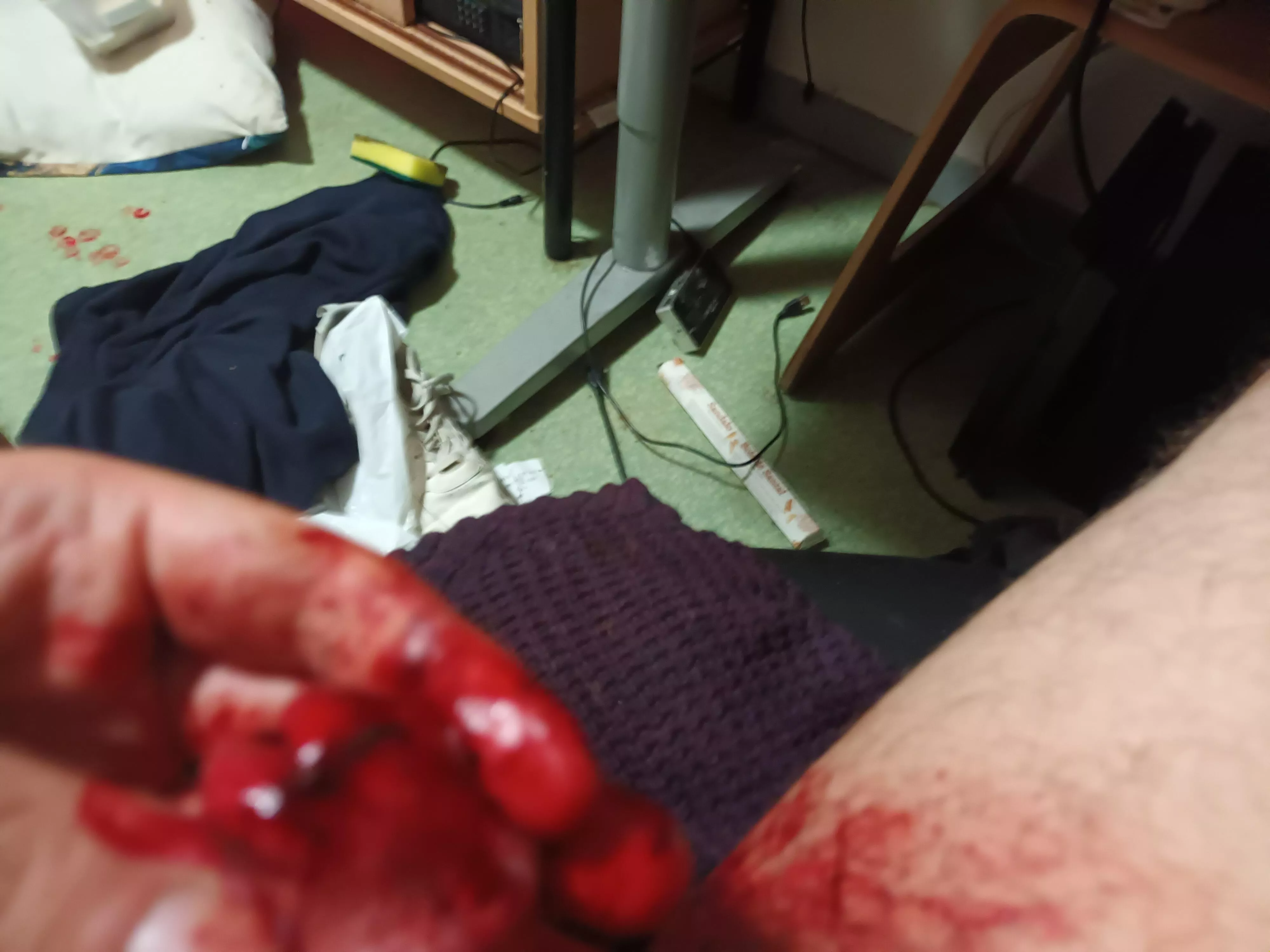 Penis live operation