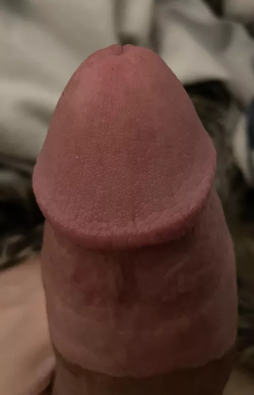 Should me teen glans be so leathery?