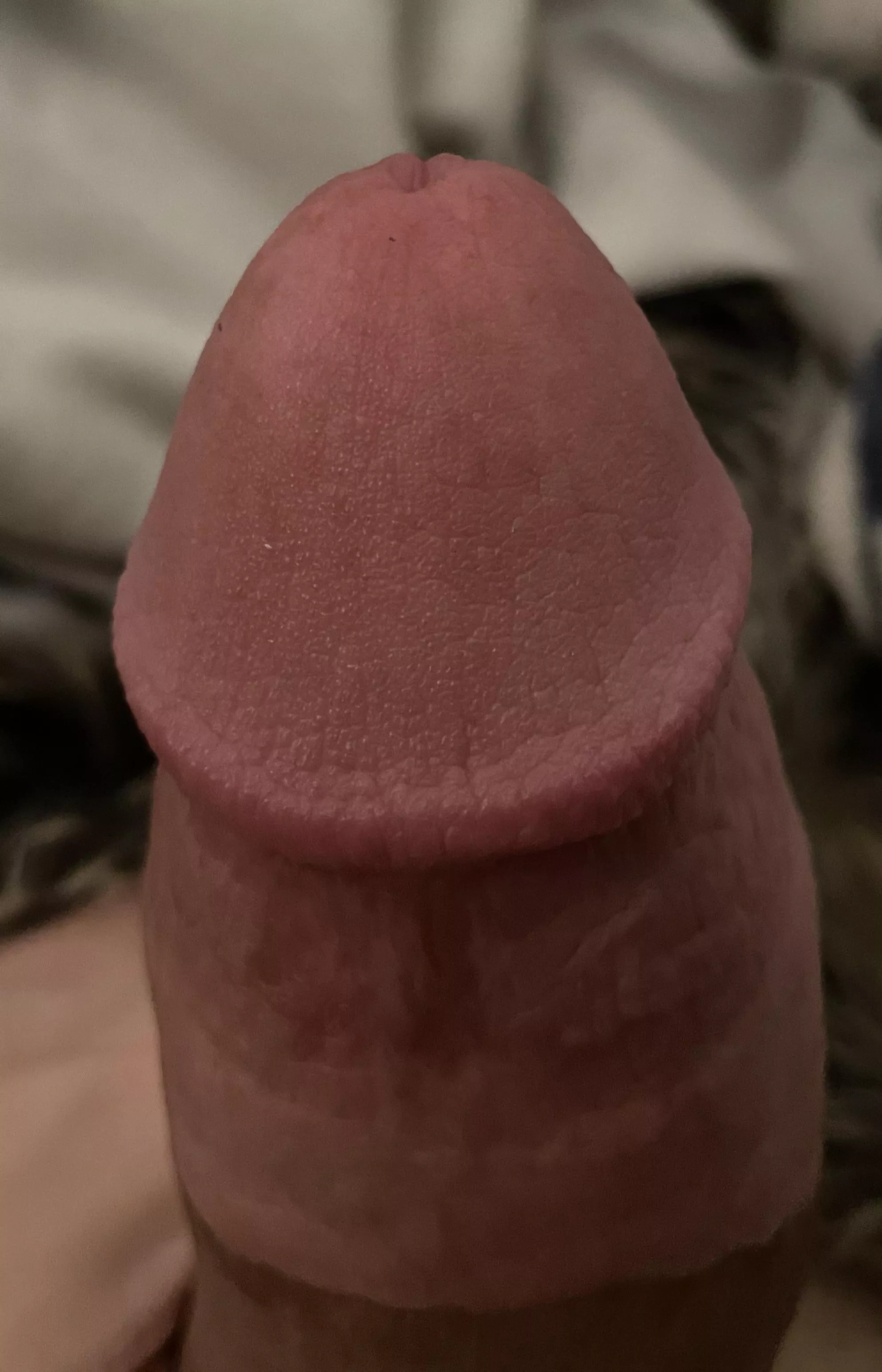 Should me teen glans be so leathery?