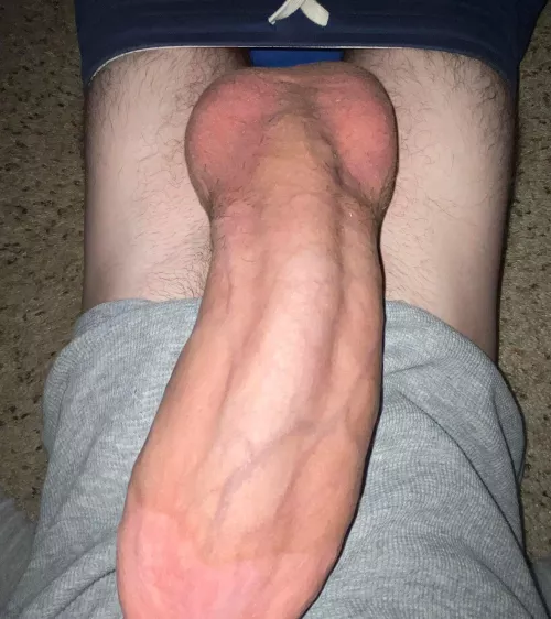 That wasn’t Tylenol!!!!