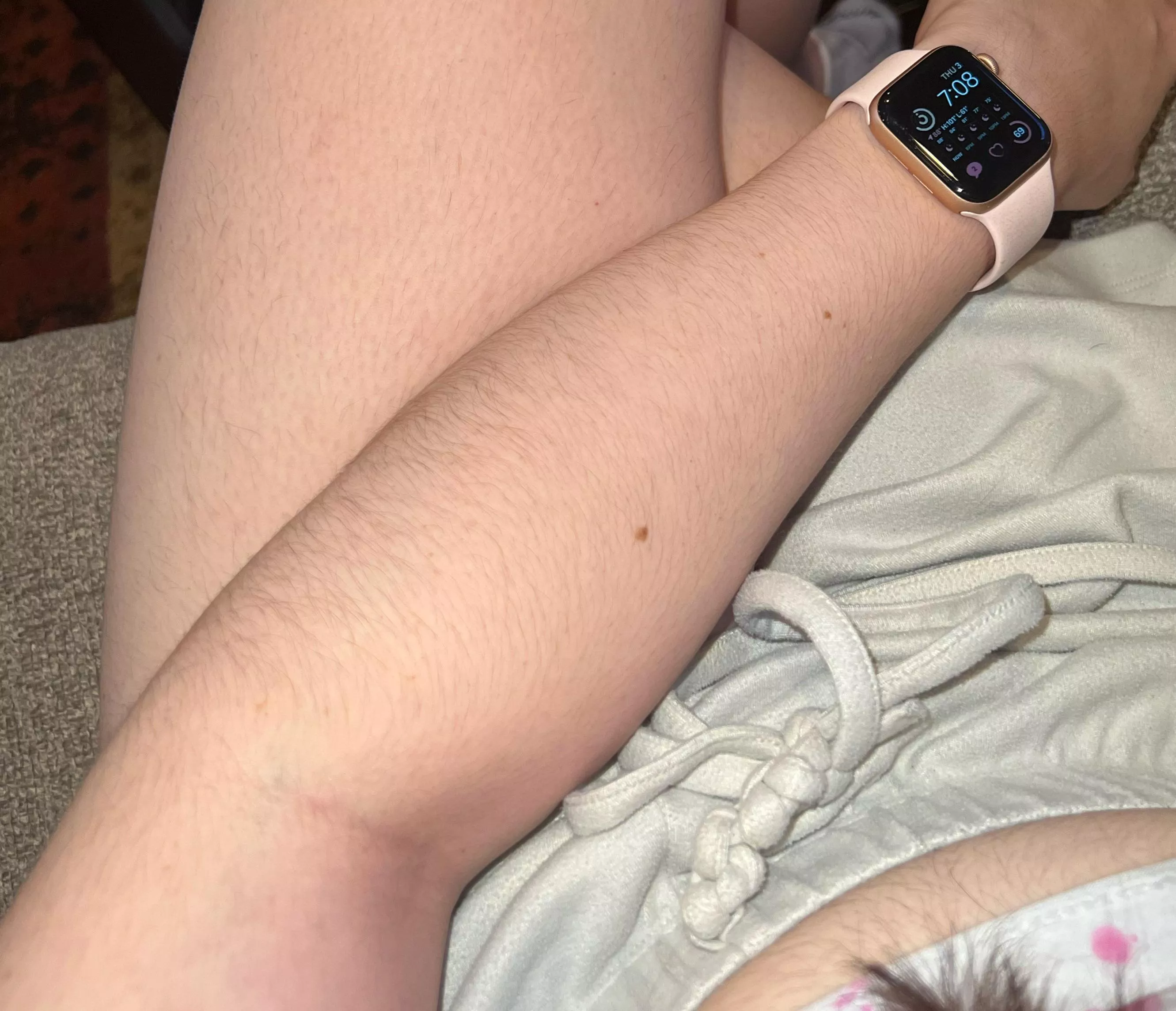 you a fan of dark hair on [arms]? 