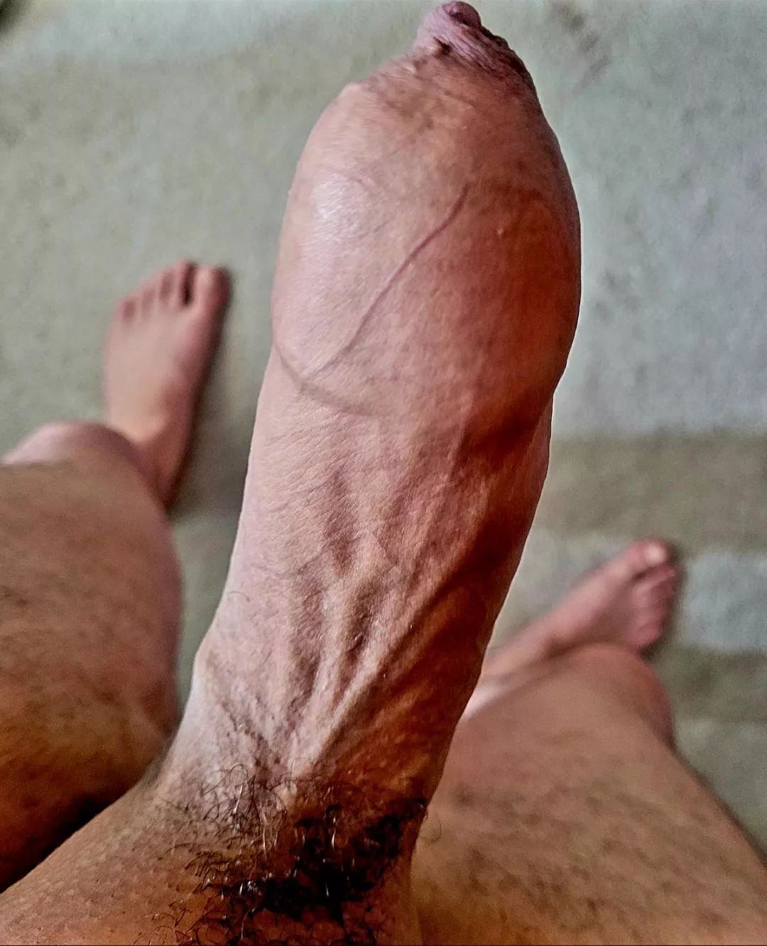 [34] fully covered head