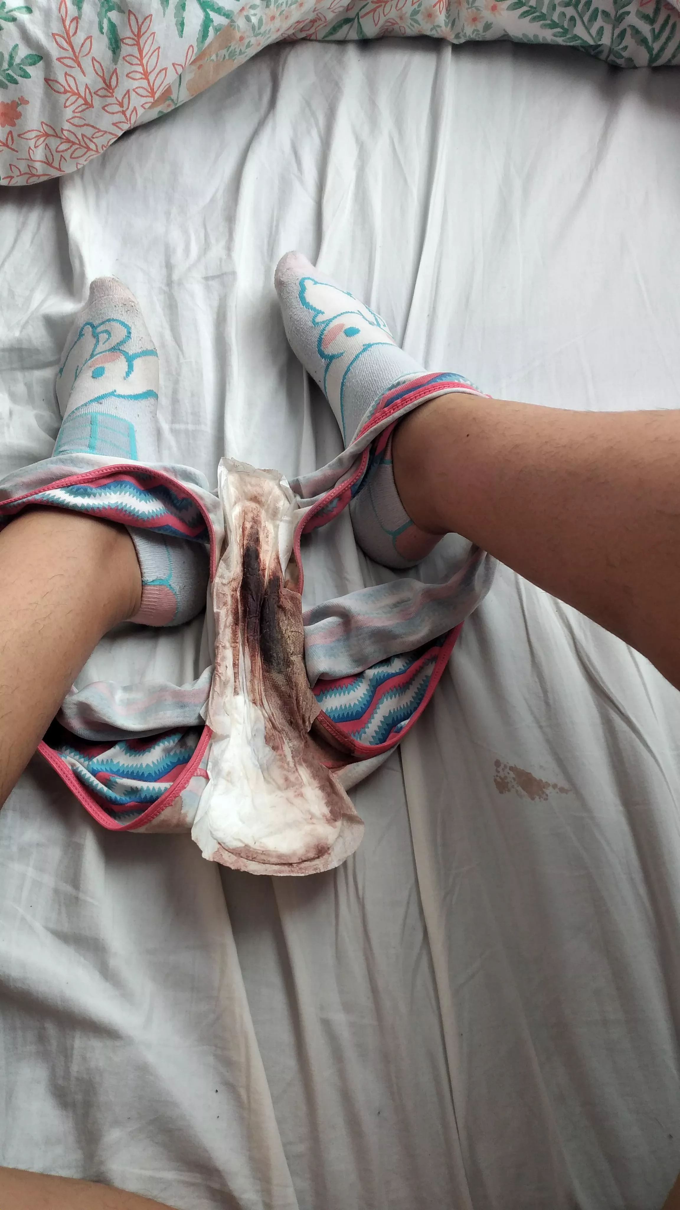 At least I didn't ruin my cinnamoroll socks ;((