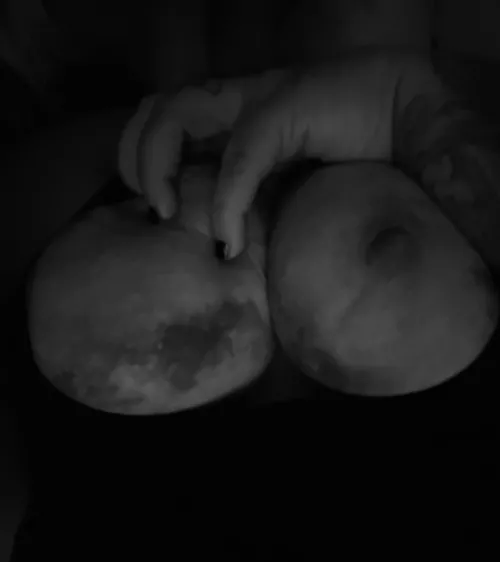 Bruised breasts look like the moon 😻