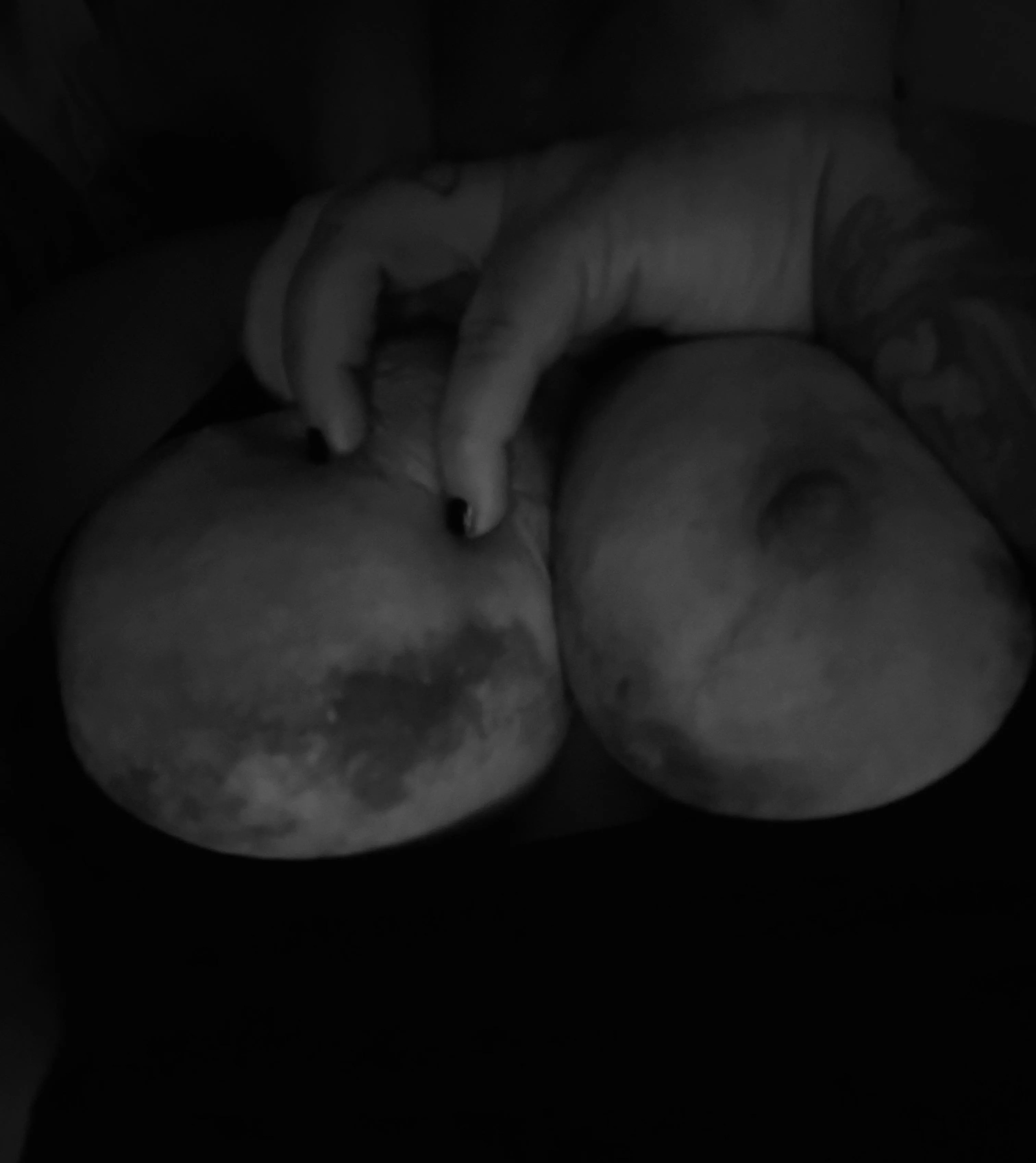 Bruised breasts look like the moon 😻