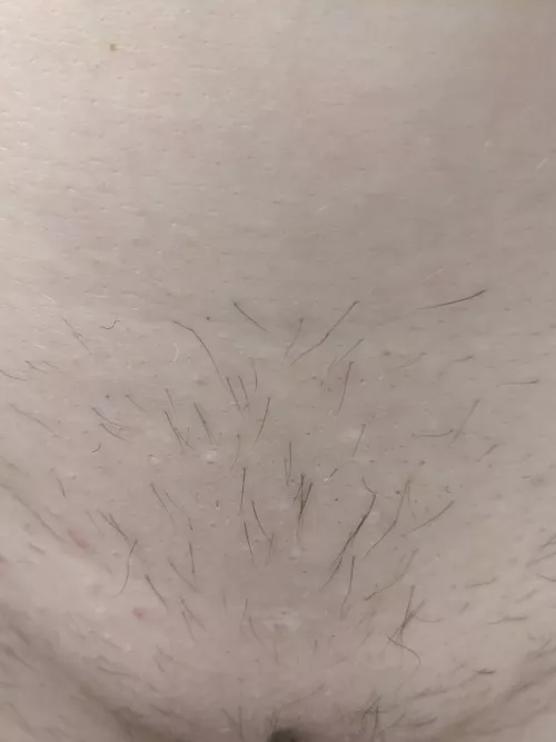 Can I still can a brazilian even if my hair has grown back patchy?