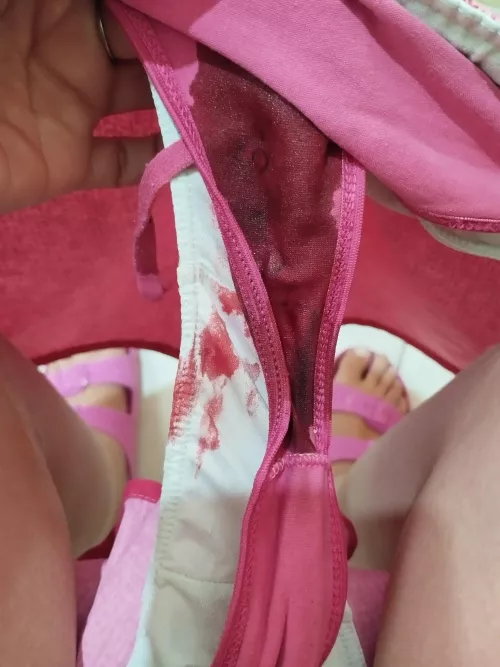 Day 3. I had an accident 