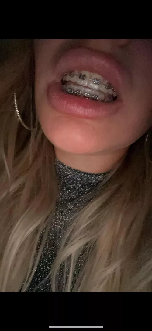 Do you think sperm looks good on my braces ?