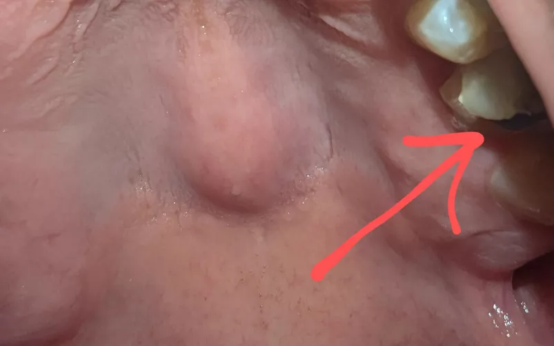 Does my temporary crown supposed to look like this? Severe pain. 