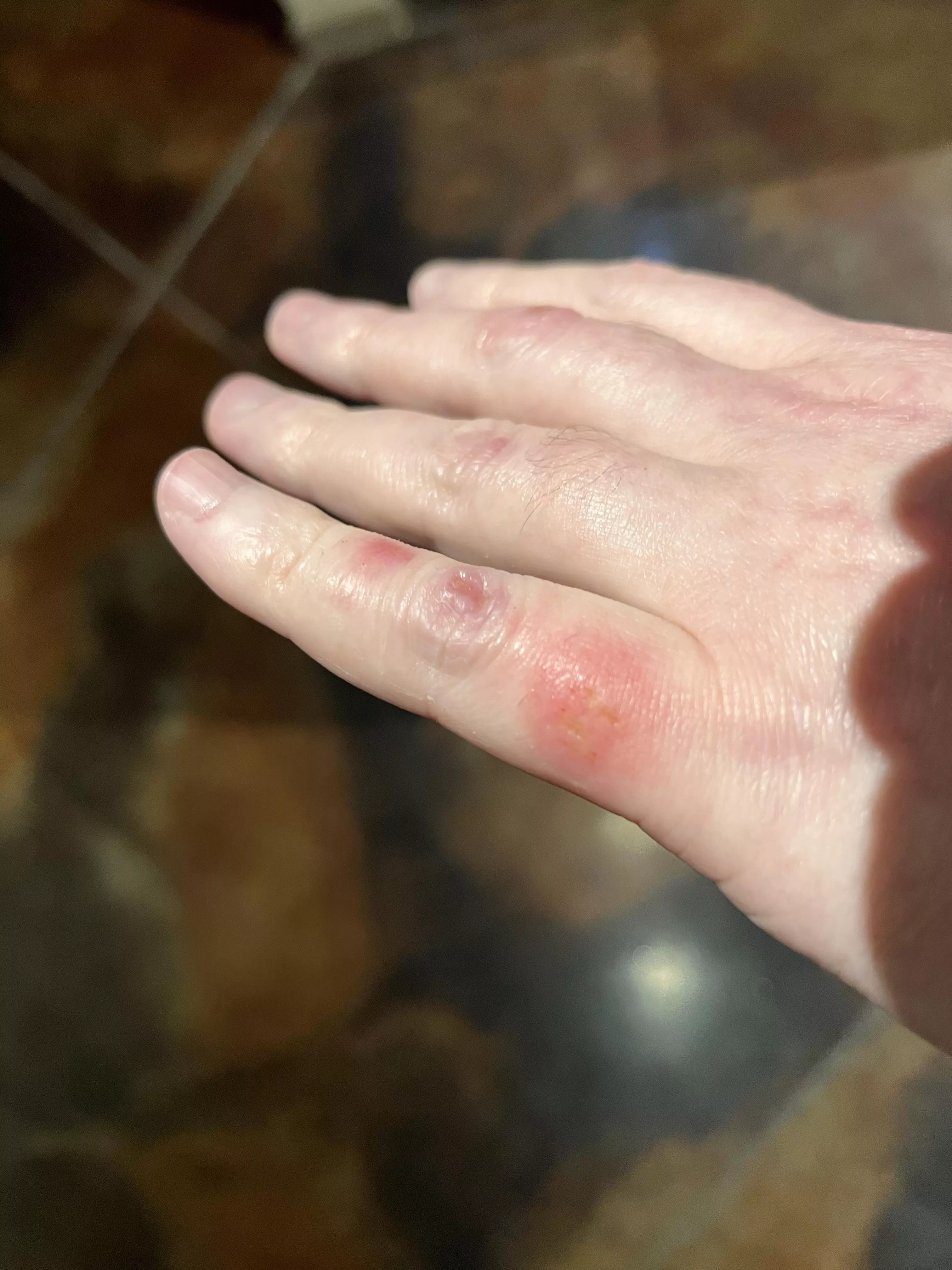 Does this look infected? 