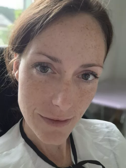 gifted with freckles